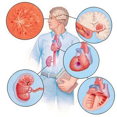 Cardiol verhënnert d'Entwécklung vu concomitant Krankheeten